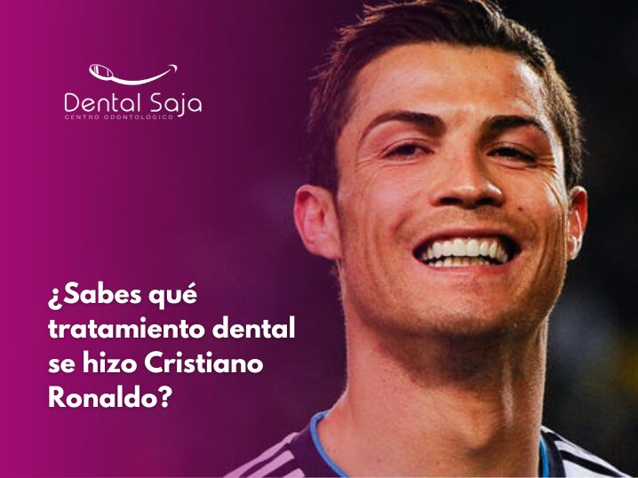 ¿Qué tratamiento dental se hizo Cristiano Ronaldo?